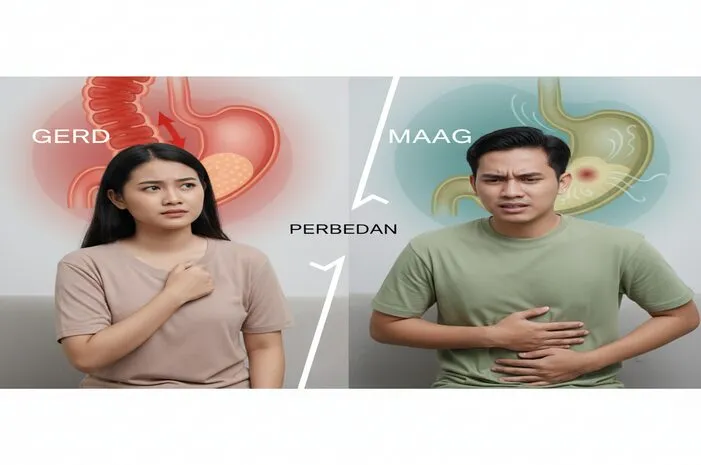 Perbedaan Gerd dan Maag: Jangan Sampai Salah!