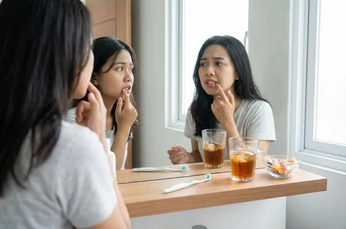 Penyebab Gigi Keropos di Usia Muda yang Sering Disepelekan