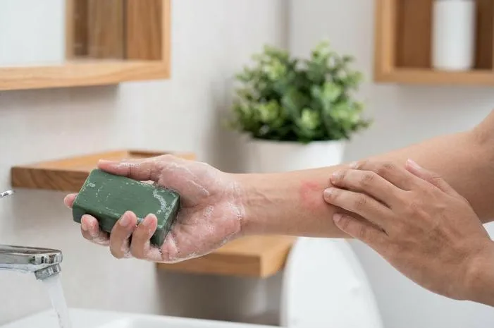 Sabun Asepso untuk Gatal: Antiseptik Ampuh, Gatal Plong!