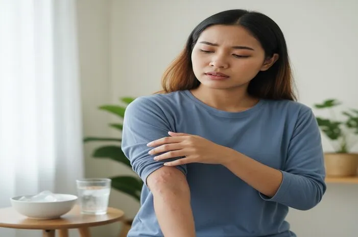 Biduran Alergi Dingin? Begini Cara Mencegah dan Atasinya