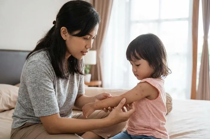 Kenali Penyebab Kudis Akibat Tungau dan Cara Menularnya