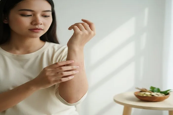 Penyebab Eksim Kulit: Kenali Biar Nggak Kambuh Lagi!