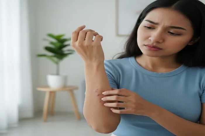 Gatal Bentol Kecil Mengganggu? Atasi dengan Cepat!