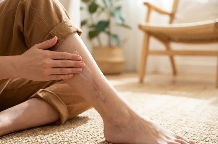 Cepat Menghilangkan Bekas Luka di Kaki, Langsung Mulus
