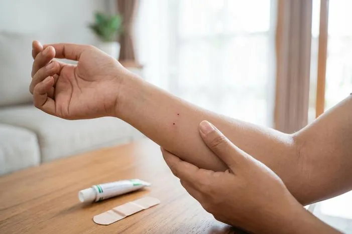 Bekas Gigitan Ular Kecil? Ini Pertolongan Pertamanya