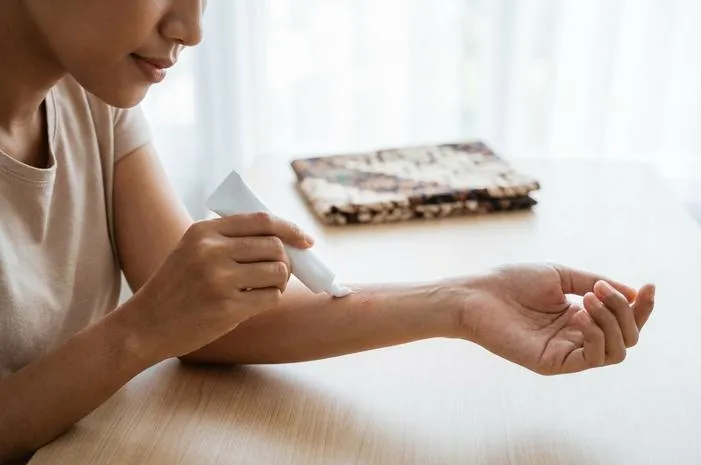 Fungsi Formyco Salep Obat: Atasi Kurap, Panu, Kutu Air