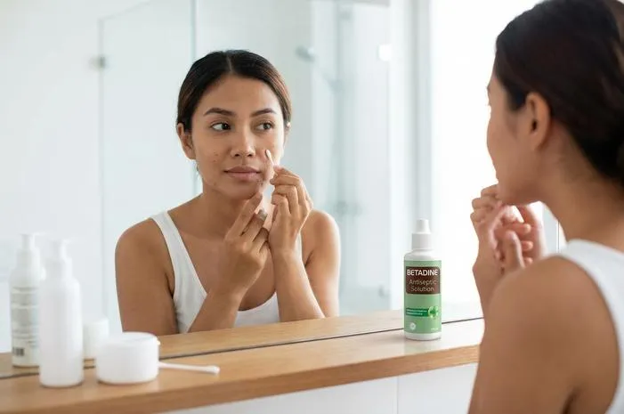 Betadine di Muka? Ternyata Boleh, Asal Tahu Cara Benar