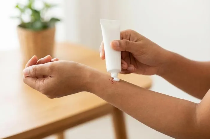 Jangan Pakai Kloderma untuk Luka, Ini Alasannya