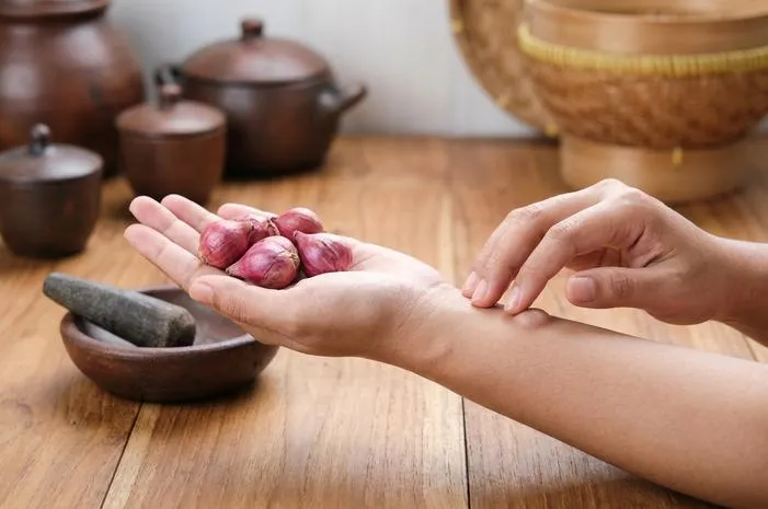Ternyata Ini Manfaat Bawang Dayak untuk Benjolan di Tubuh
