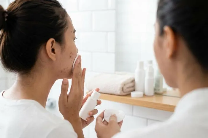 Merawat Wajah Berjerawat? Begini Cara Praktisnya!