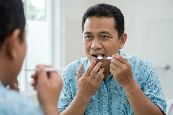 Awas! Gambar Kanker Mulut Stadium Awal yang Perlu Kamu Tahu