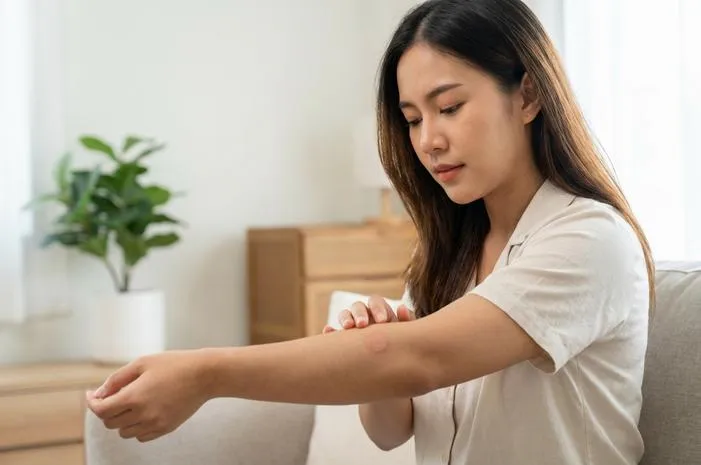 Jenis Kurap: Kenali dari Lokasi di Tubuhmu