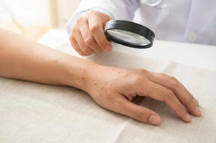 Bintik Bintik Merah di Tangan: Kenali Penyebab dan Solusinya