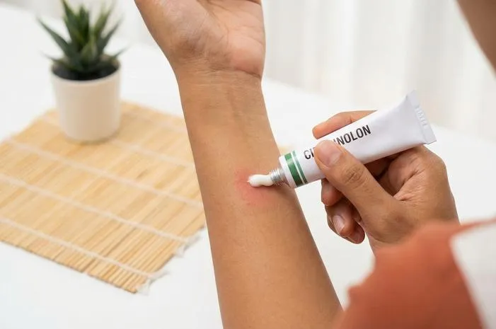 Cinolon Salep untuk Gatal, Radang, Alergi Kulit