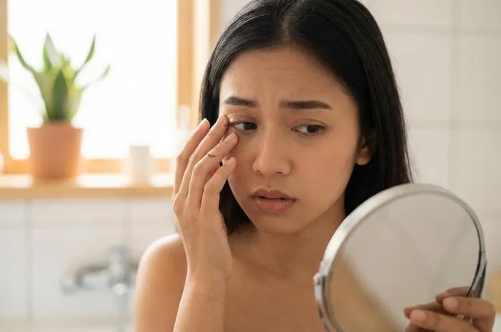 Bukan Cuma Penuaan, Ini Kenapa Bulu Mata Rontok