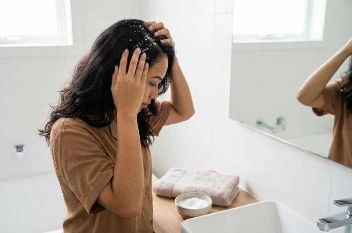 Cara Menghilangkan Ketombe dengan Garam, Yuk Coba!