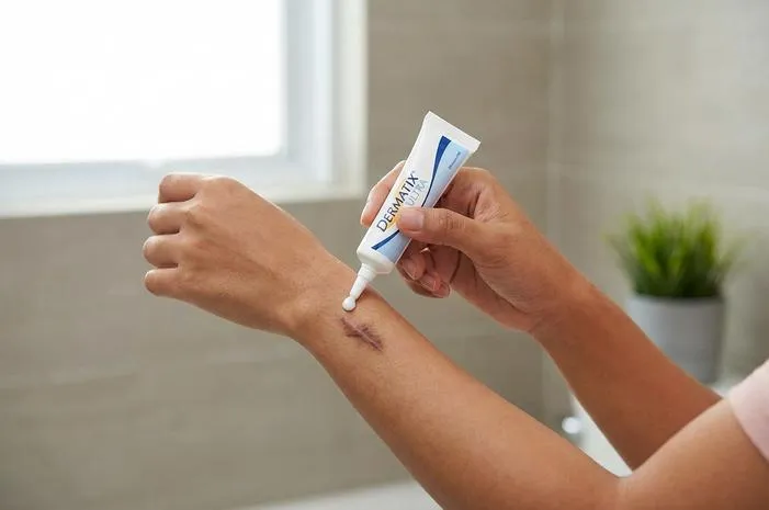 Bisa Gak Dermatix Hilangkan Bekas Luka Menghitam Total?