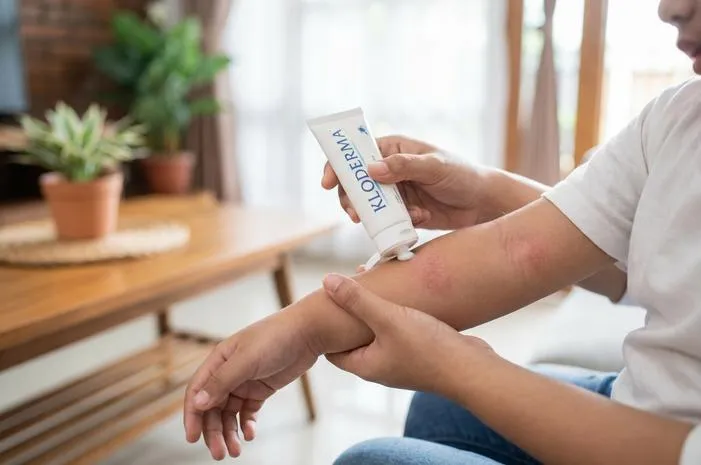 Kloderma Salep Untuk Penyakit Apa? Ini Jawabannya Lengkap