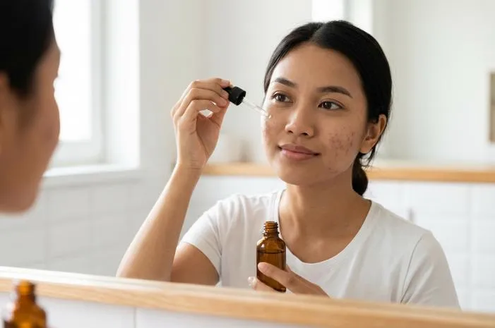 Apakah Serum Vitamin C Bisa Menghilangkan Bekas Jerawat?