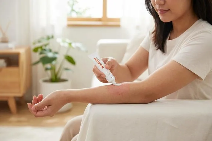 Noroid untuk Eksim: Terbukti Efektif Atasi Gatal!