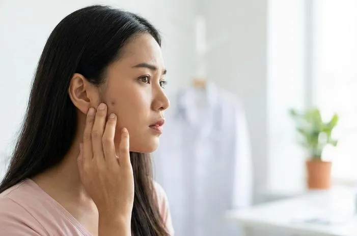 Fistula Preaurikular: Jangan Anggap Remeh Lubang Ini!