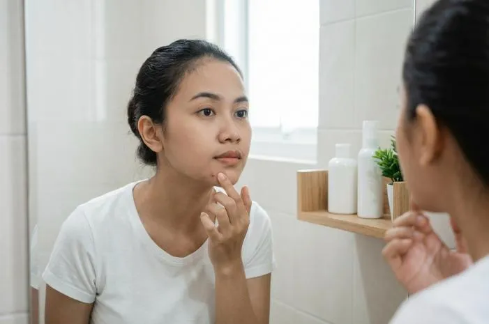 Cara Ampuh Atasi Pimple Biar Wajah Kembali Mulus