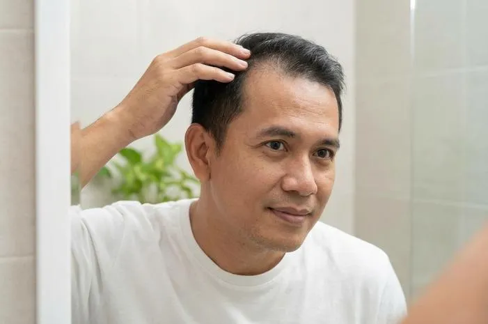 Tips Cara Cepat Menumbuhkan Rambut Botak Dalam 1 Minggu