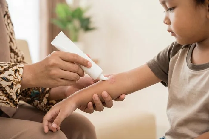 Cicaplast Kuatkan Skin Barrier Redakan Iritasi