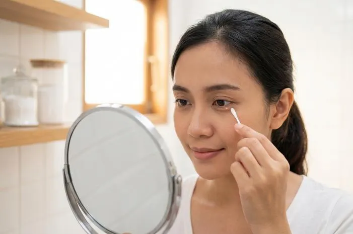 Benjolan Putih di Kelopak Mata Bagian Dalam, Atasi Begini