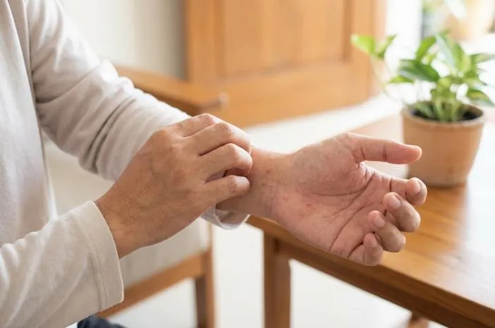 Tangan Gatal Bintik Kecil? Ini Penyebab dan Solusinya