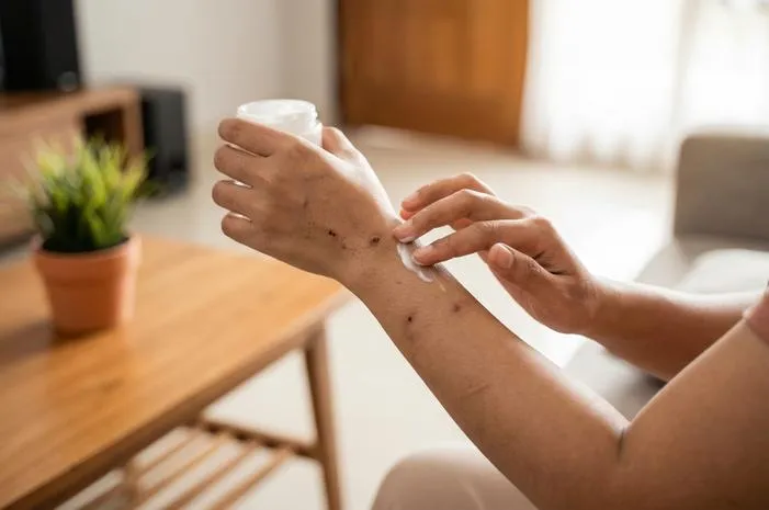 Cara Ampuh Mengatasi Darah Manis, Kulit Mulus Lagi!