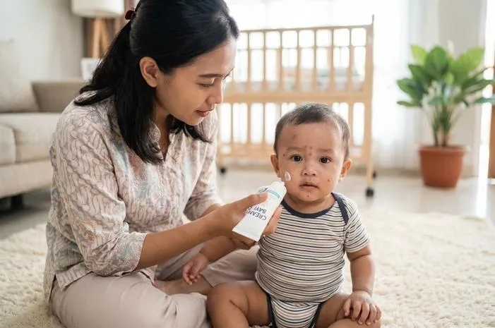 Obat Bruntusan pada Bayi: Perawatan dan Solusi Aman