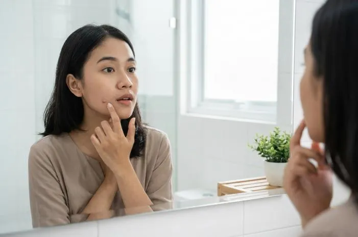 Bentol di Wajah Bukan Jerawat? Ini Penyebabnya!