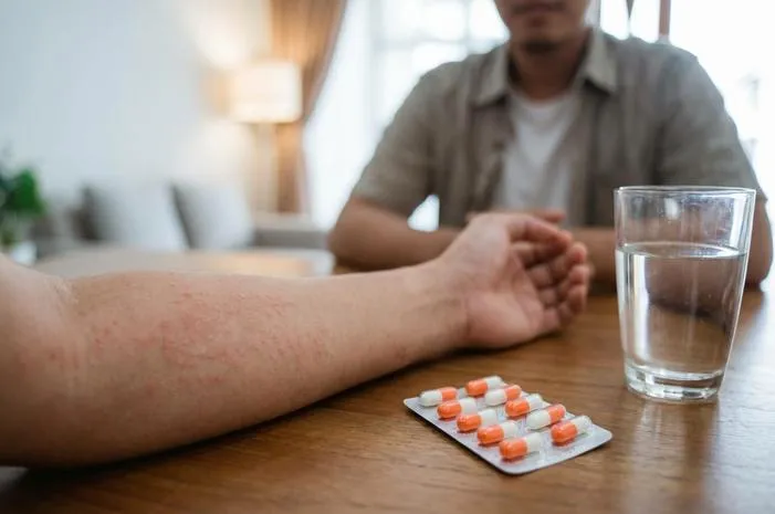 Waspada Alergi Amoxicillin: Gejala dan Penanganan Tepat