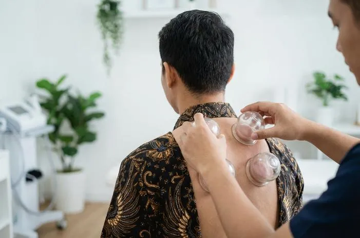 Bekam Kering: Lancarkan Darah, Redakan Nyeri Otot