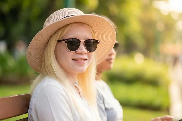 Memahami Albinisme: Pesona Kulit Putih Butuh Proteksi