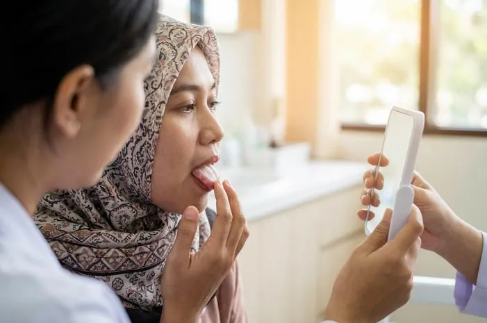 Lidah Putih Tipes: Kenali, Pahami, dan Atasi!