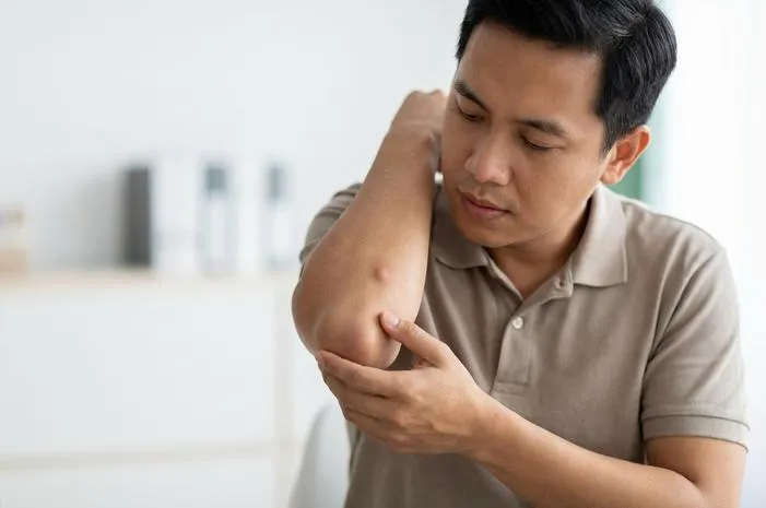 Benjolan di Siku Tangan? Tenang, Ini Sebabnya