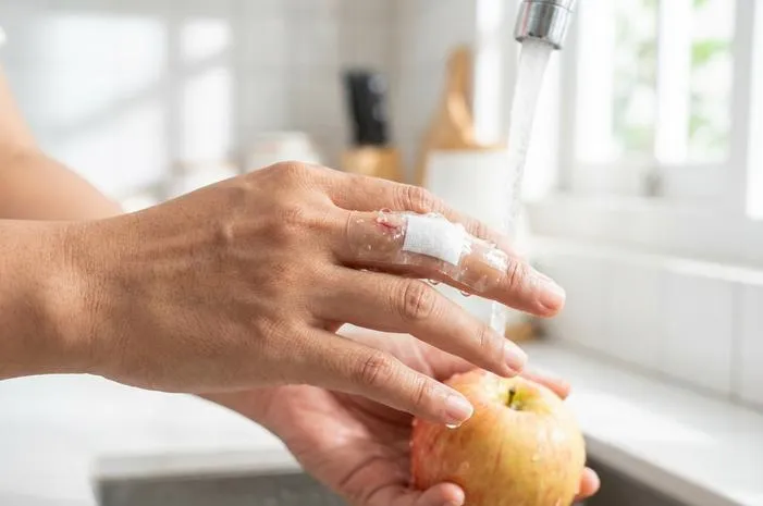 Kasa Anti Air: Bebas Mandi, Luka Kering Terlindungi Optimal