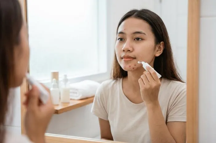 Cara Hilangkan Jerawat Batu agar Kulit Mulus Lagi
