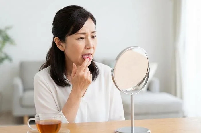 Lidah Sakit Jangan Panik! Ini Solusi Mudah Atasinya