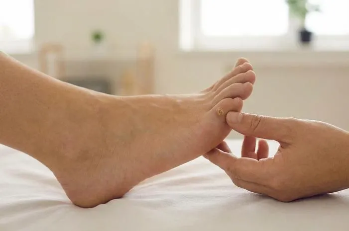 Gejala Mata Ikan: Kenali Ciri-cirinya Sejak Dini