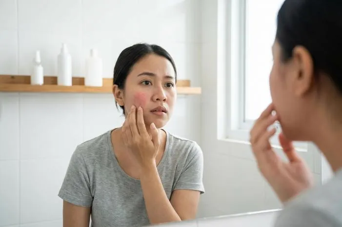 Muka Iritasi? Redakan Cepat, Kulit Nyaman Lagi!