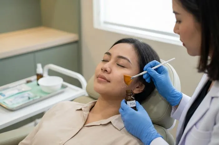 TCA: Peeling Ampuh Kulit Cerah, Apa Aman Dipakai Sendiri?