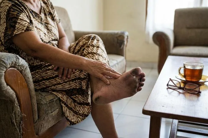 Kaki Diabetes Menghitam: Kenali Tanda, Cegah Amputasi.