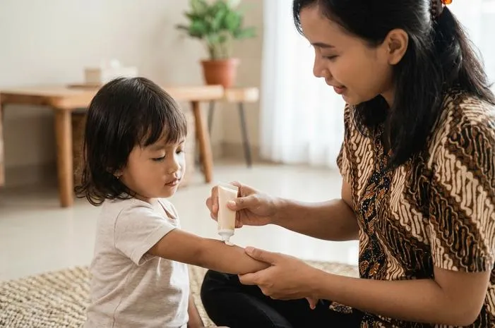 Salep untuk Impetigo Anak, Ampuh dan Aman untuk Si Kecil