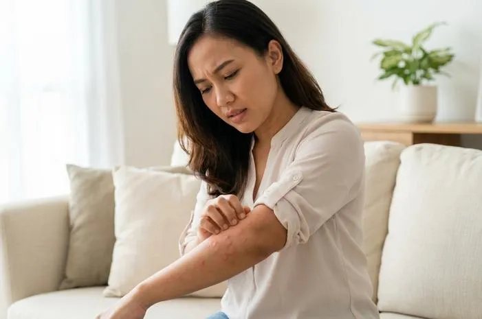 Urtikaria Kronis: Biduran Tak Kunjung Sembuh? Ini Dia