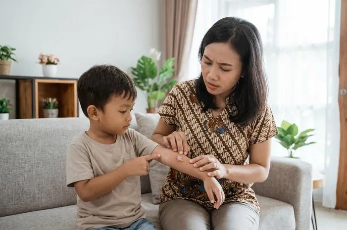 Atasi Bisul pada Anak: Tips Mudah untuk Orang Tua