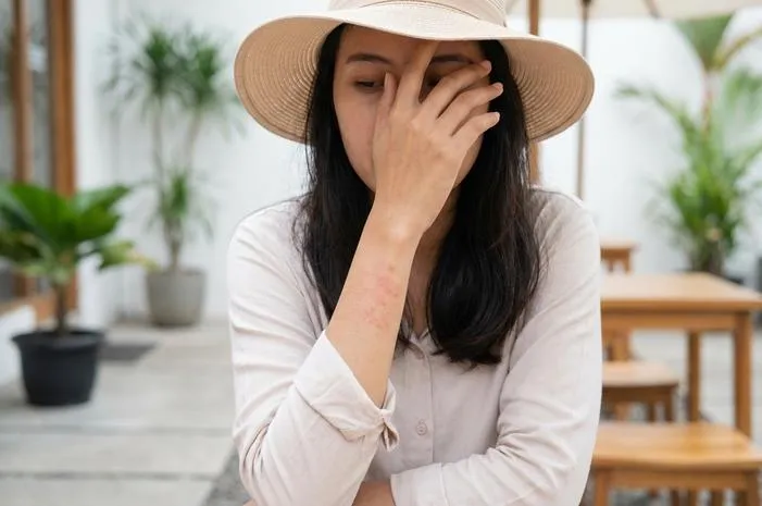 Kulit Gatal Setelah Berjemur? Mungkin Itu Alergi Matahari