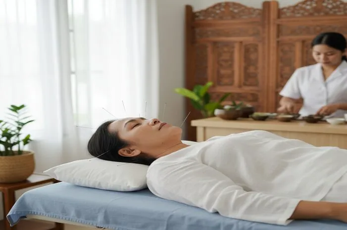 Acupuncture: Rahasia Tubuh Sehat Tanpa Obat